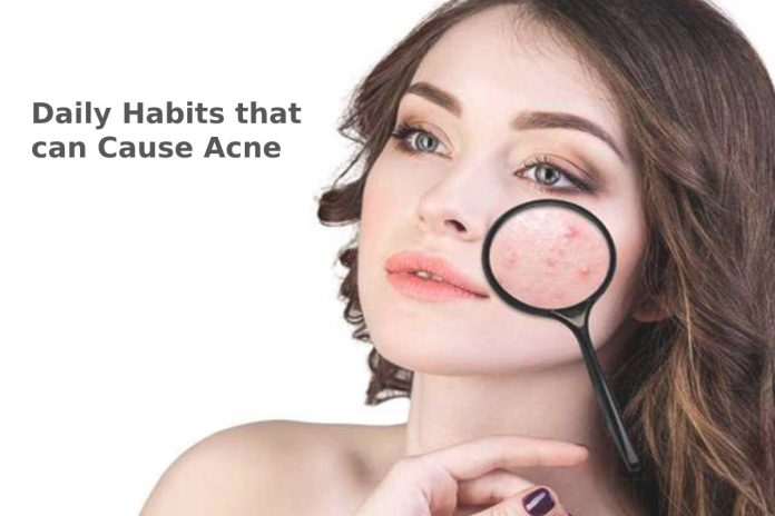 Daily Habits that can Cause Acne - The Makeup and Beauty