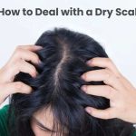 How to Deal with a Dry Scalp How to Deal with a Dry Scalp