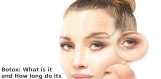 Botox: What is it and How long do its Effects Last? Botox: What is it and How long do its Effects Last?