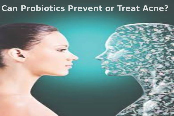 Can Probiotics Prevent or Treat Acne?