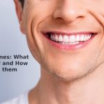 Smile Lines: What are they and How to Avoid them Smile Lines: What are they and How to Avoid them