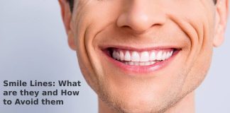 Smile Lines: What are they and How to Avoid them Smile Lines: What are they and How to Avoid them