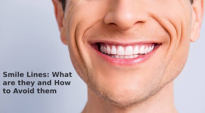 Smile Lines: What are they and How to Avoid them Smile Lines: What are they and How to Avoid them