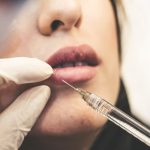 Cosmetic Surgeries that Can Be Covered By Insurance cosmetic surgeries