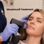 What You Need to Know About Morpheus8 Treatment? Morpheus8 Treatment