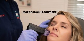 What You Need to Know About Morpheus8 Treatment? Morpheus8 Treatment