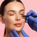 5 Things You Must Know Before You Get a Nose Job nose job