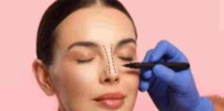 5 Things You Must Know Before You Get a Nose Job nose job