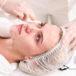 Take a Look at How The Best Acne Treatment For Kids Is Designed acne treatment