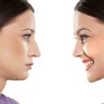 Should You Get a Nose Job? What Can It Accomplish? should you get a nose job