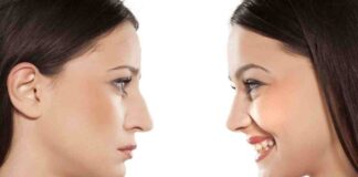 Should You Get a Nose Job? What Can It Accomplish? should you get a nose job