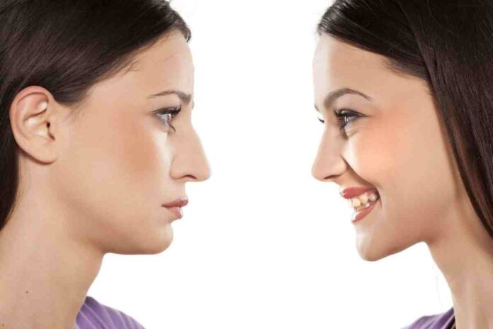 should you get a nose job should you get a nose job