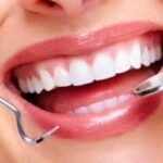 Top Cosmetic Dental Procedures – What You should Know? cosmetic dental procedures