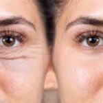 Signs You Might Need an Eye Lift eye lift