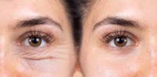 Signs You Might Need an Eye Lift eye lift