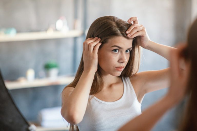 How to keep your Scalp Healthy?