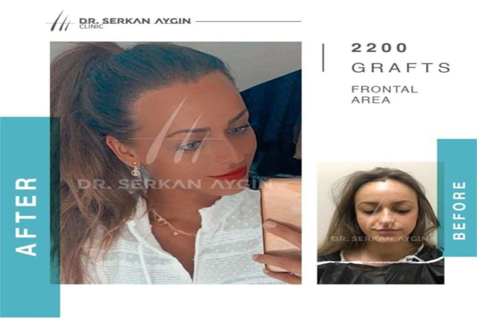 Dr. Serkan Aygin Clinic