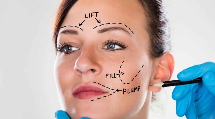Looking for the BEST Facelift Surgeon Near You? Ask These 11 Questions Facelift Surgeon