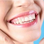 Shaping Smiles with Large-Scale Bone Removal in Las Vegas Shaping Smiles with Large-Scale Bone Removal in Las Vegas