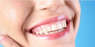 Shaping Smiles with Large-Scale Bone Removal in Las Vegas Shaping Smiles with Large-Scale Bone Removal in Las Vegas