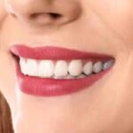 Shaping Smiles with Large-Scale Bone Removal in Las Vegas Shaping Smiles with Large-Scale Bone Removal in Las Vegas