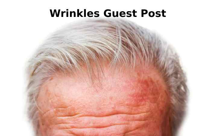 Wrinkles Guest Post